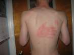Now that's a five star....ouch.JPG