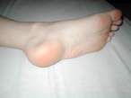 Feet.jpg