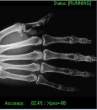 xray.jpg
