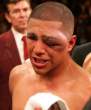fernando-vargas-eye.jpg