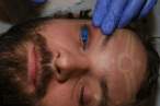 eye1img_assist_custom.jpg