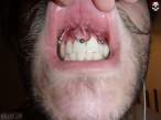 noz4-smile.jpg