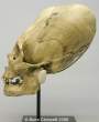 peruvian_female_(skull_binding_100bc)-www.boneclones.com.JPG